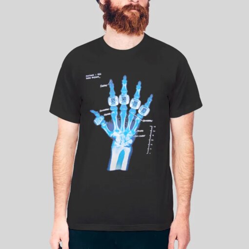 Hand X Ray Kobe Broken Hand Shirt