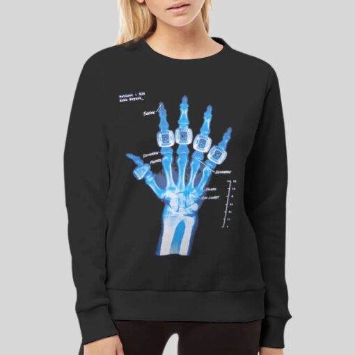 Hand X Ray Kobe Broken Hand Shirt