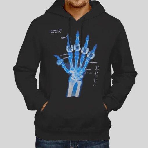 Hand X Ray Kobe Broken Hand Shirt